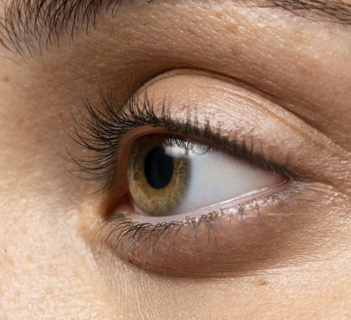 effets secondaire détatouage laser