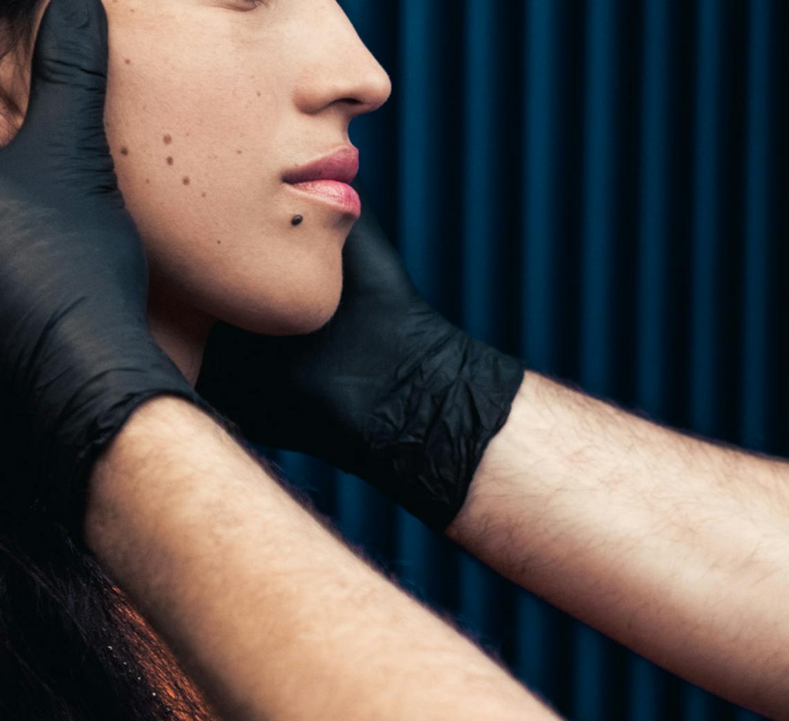 combien de séances pour une épilation laser