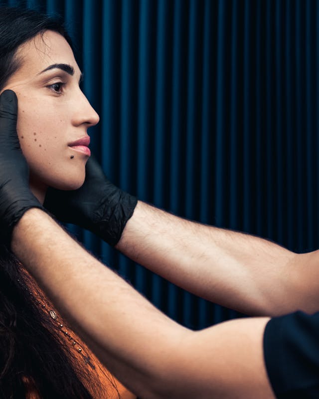 Botox pour affiner la mâchoire