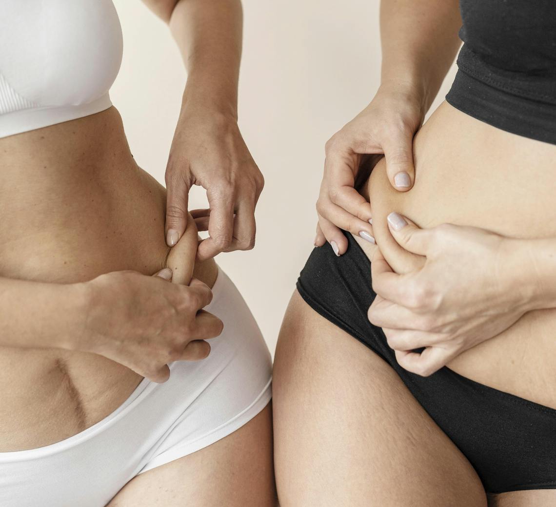 efficacité de la cryolipolyse du ventre chez Maison Yokō