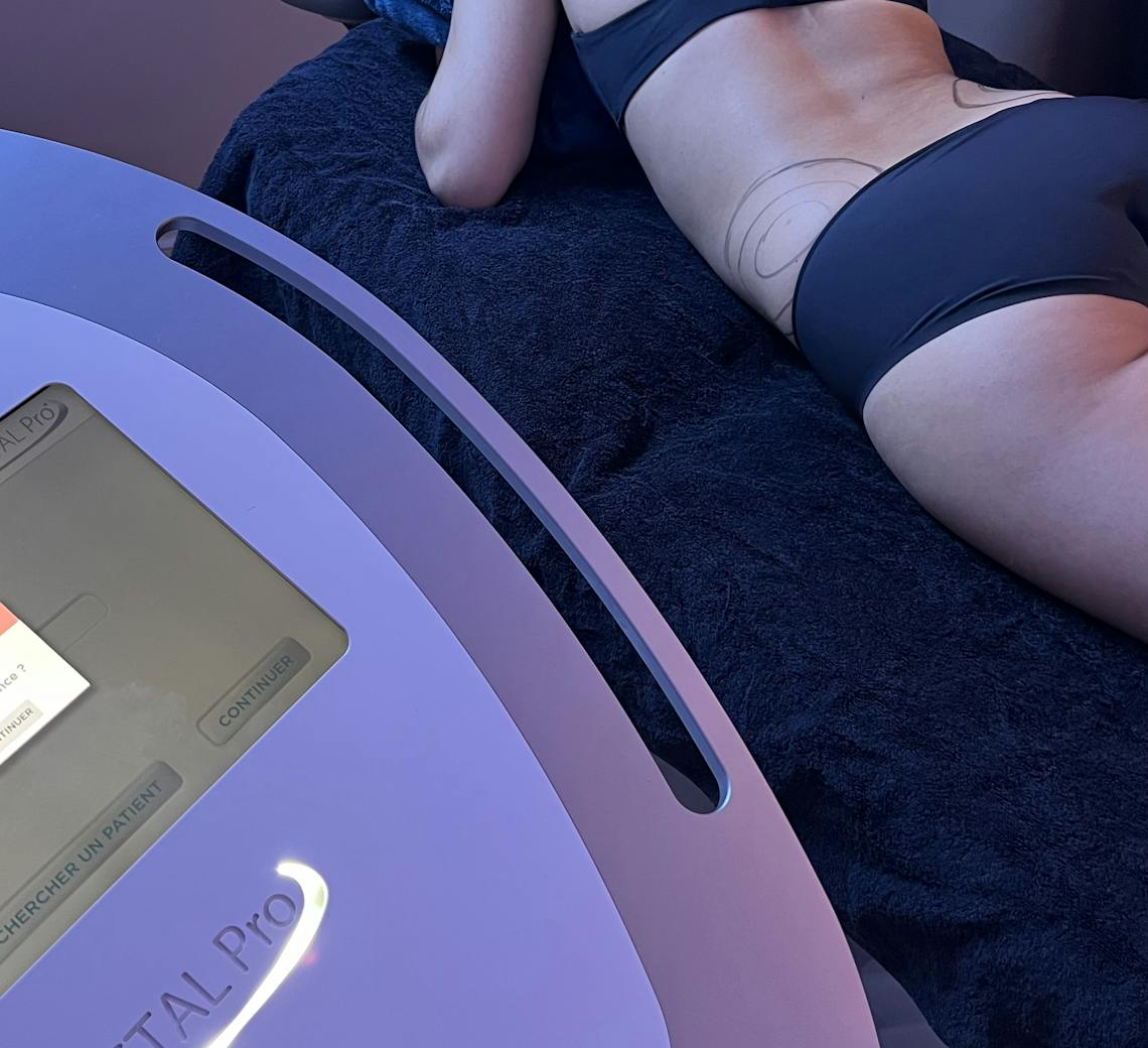 cryolipolyse médicale chez Maison Yokō