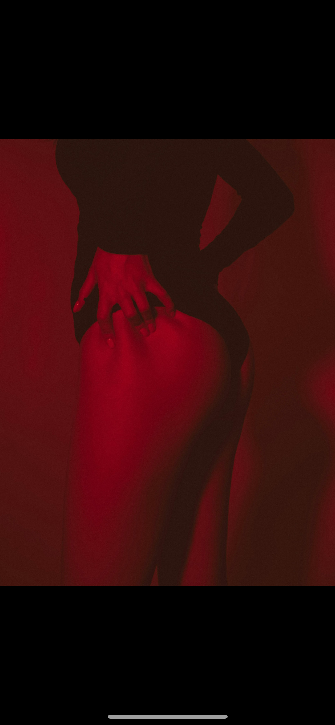 Traitement contre les vergetures à Lyon avec laser et microneedling dans le centre de médecine esthétique et laser Maison Yoko