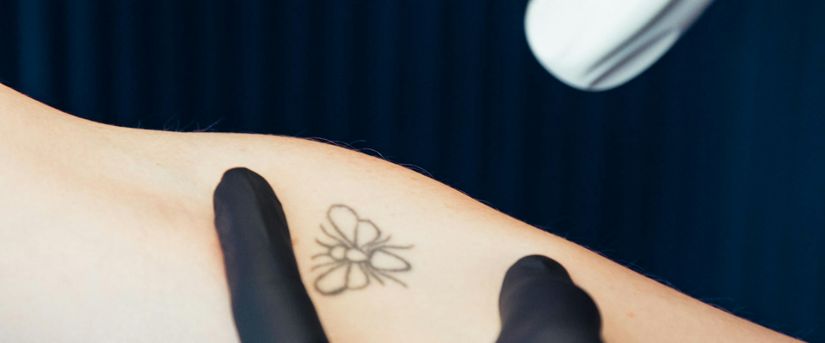 détatouage laser lyon | Maison Yokō