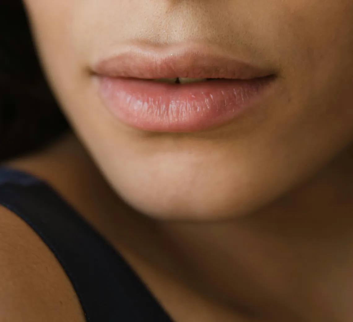 Comment agit l’acide hyaluronique sur l’asymétrie ?