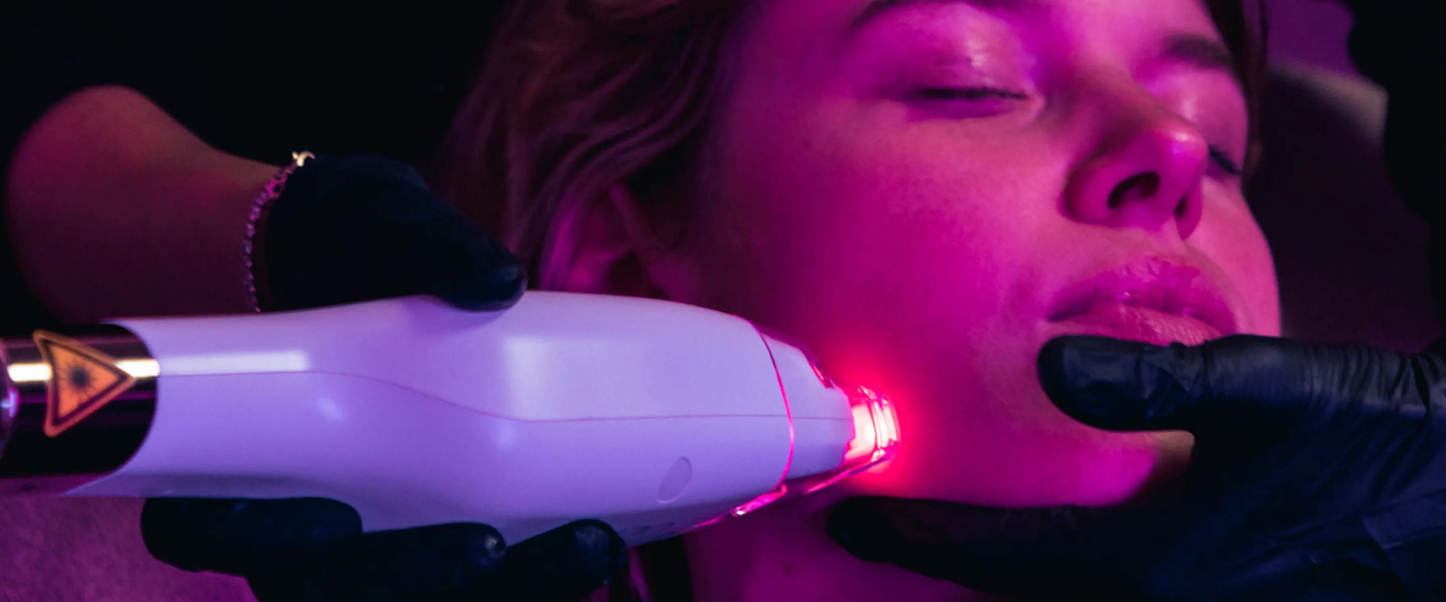 LaseMD ultra, la technologie qui améliore la qualité de peau, expliqué par les médecins du centre de Médecine Esthétique Maison Yoko à Lyon