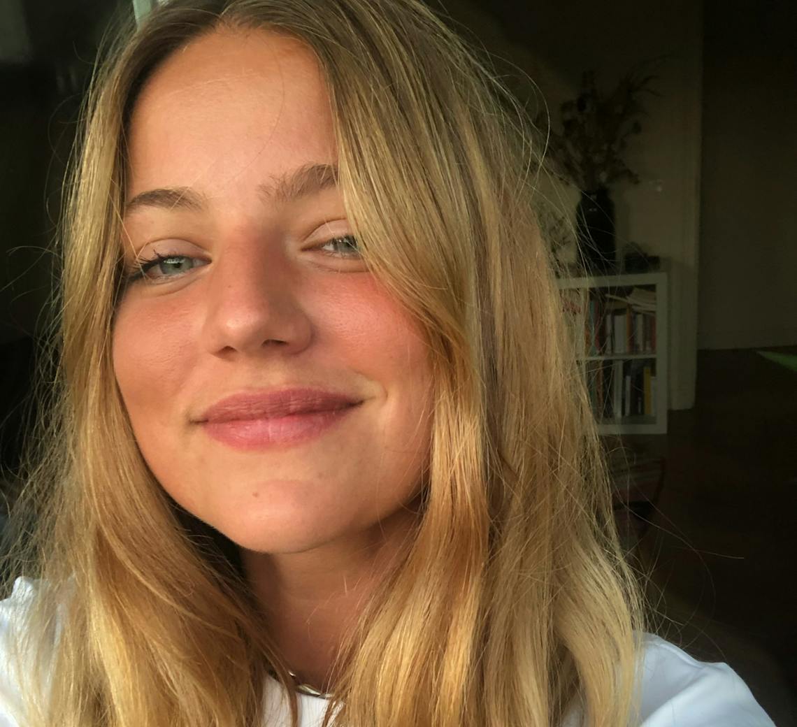 Injections d'acide hyaluronique dans les lèvres chez Maison Yoko à Lyon