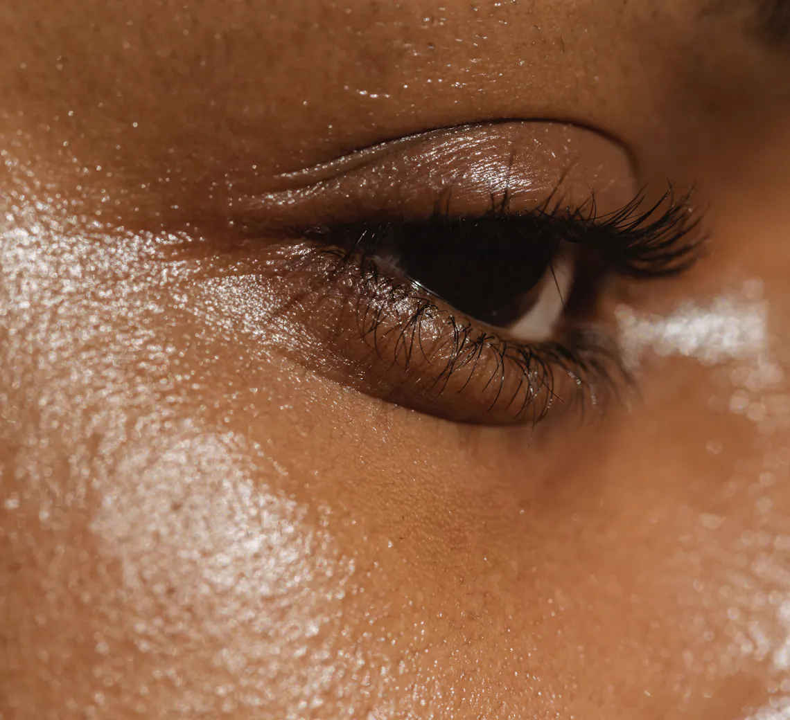 précautions avant microneedling | conseils d'expert