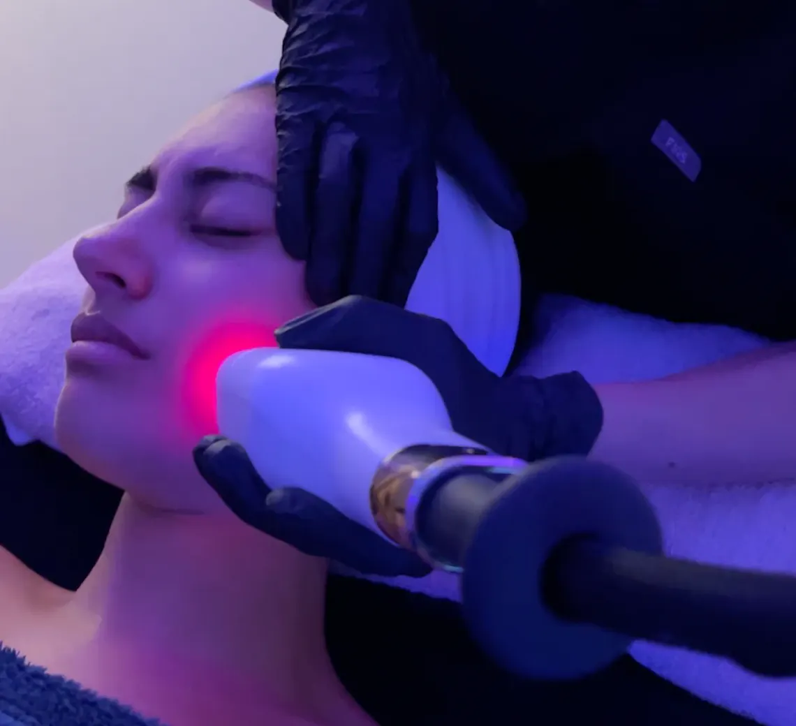 Sofia, en séance de LaseMD Ultra au centre de médecine esthétique et laser Maison Yoko