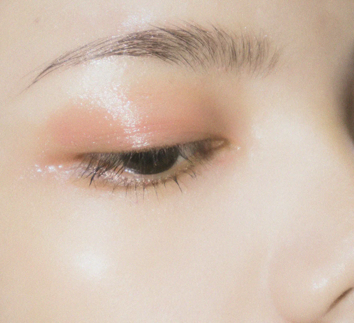 Laser Dépigmentation