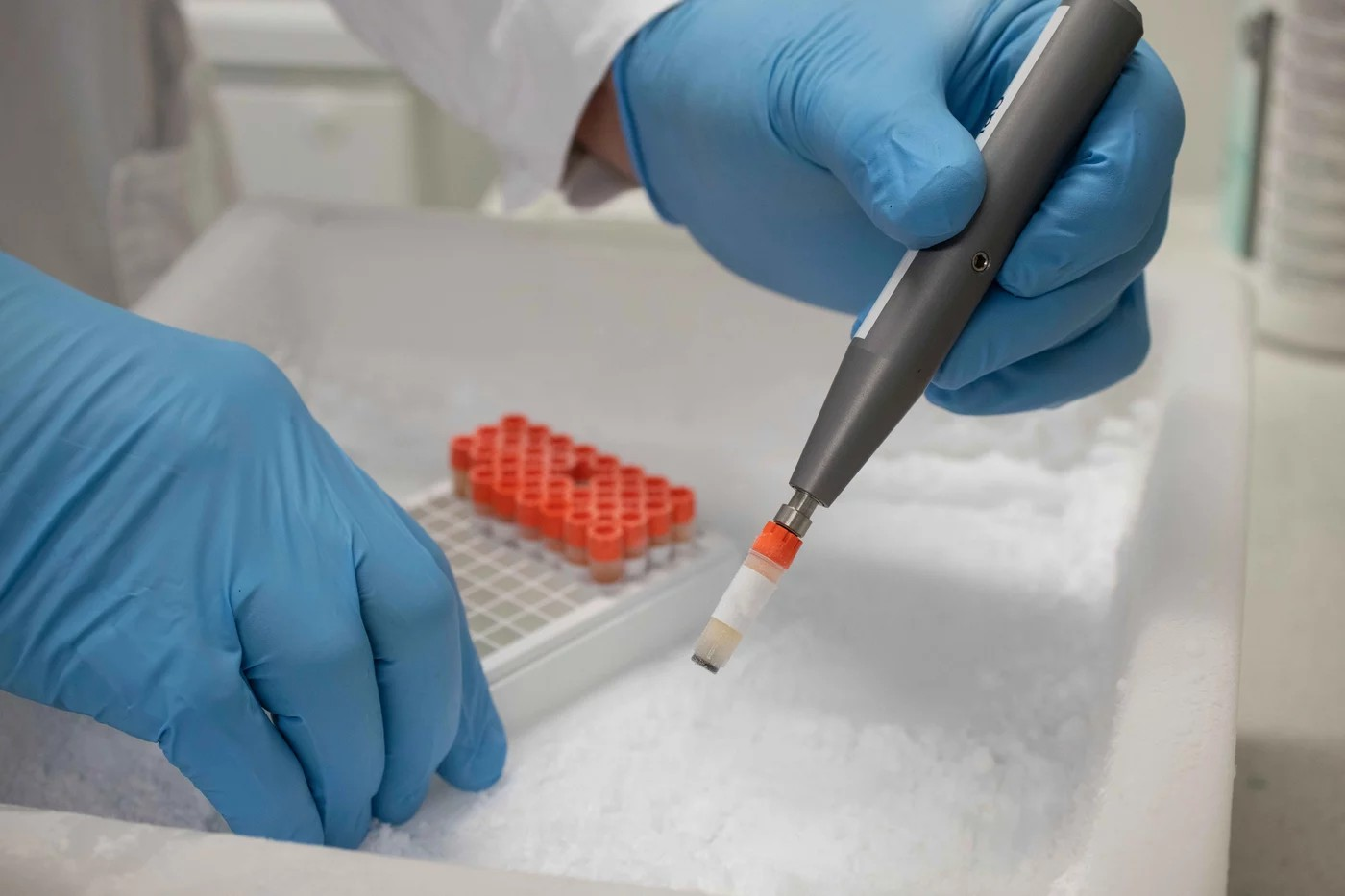 Einige Volkskrankheiten könnten sich künftig einfacher und schneller diagnostizieren lassen als bislang. Eine Probe, viele Diagnosen: Das Röhrchen enthält kaum mehr als einen Tropfen Blutplasma. Mit Infrarotlicht lassen sich daran unter anderem verschiedene Stoffwechselstörungen wie Typ-2-Diabetes, Bluthochdruck und das metabolische Syndrom diagnostizieren.