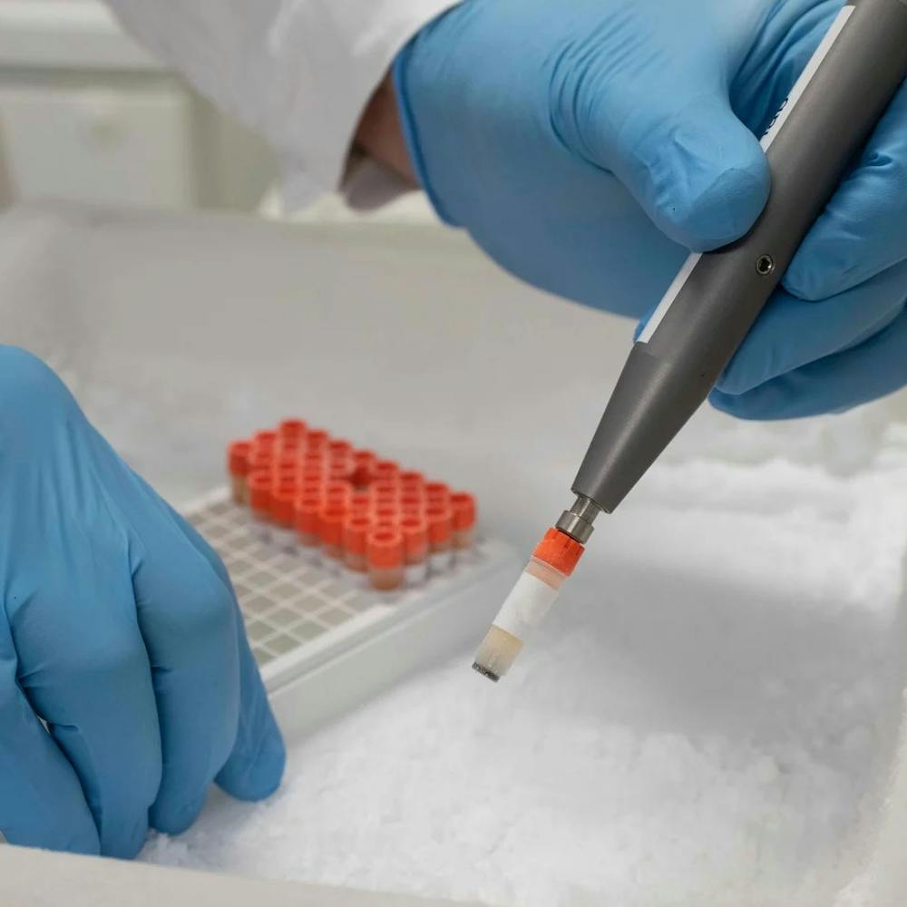 Einige Volkskrankheiten könnten sich künftig einfacher und schneller diagnostizieren lassen als bislang. Eine Probe, viele Diagnosen: Das Röhrchen enthält kaum mehr als einen Tropfen Blutplasma. | ©MPI für Quantenoptik/Thorsten Naeser Einige Volkskrankheiten könnten sich künftig einfacher und schneller diagnostizieren lassen als bislang. Eine Probe, viele Diagnosen: Das Röhrchen enthält kaum mehr als einen Tropfen Blutplasma.