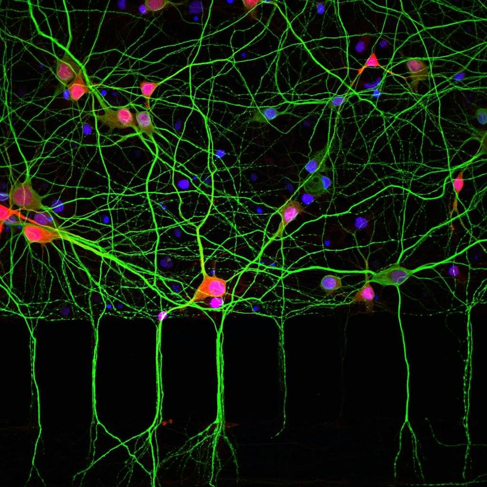 Nervenzellen Netz | ©MPI für Hirnforschung Nervenzellen Netz