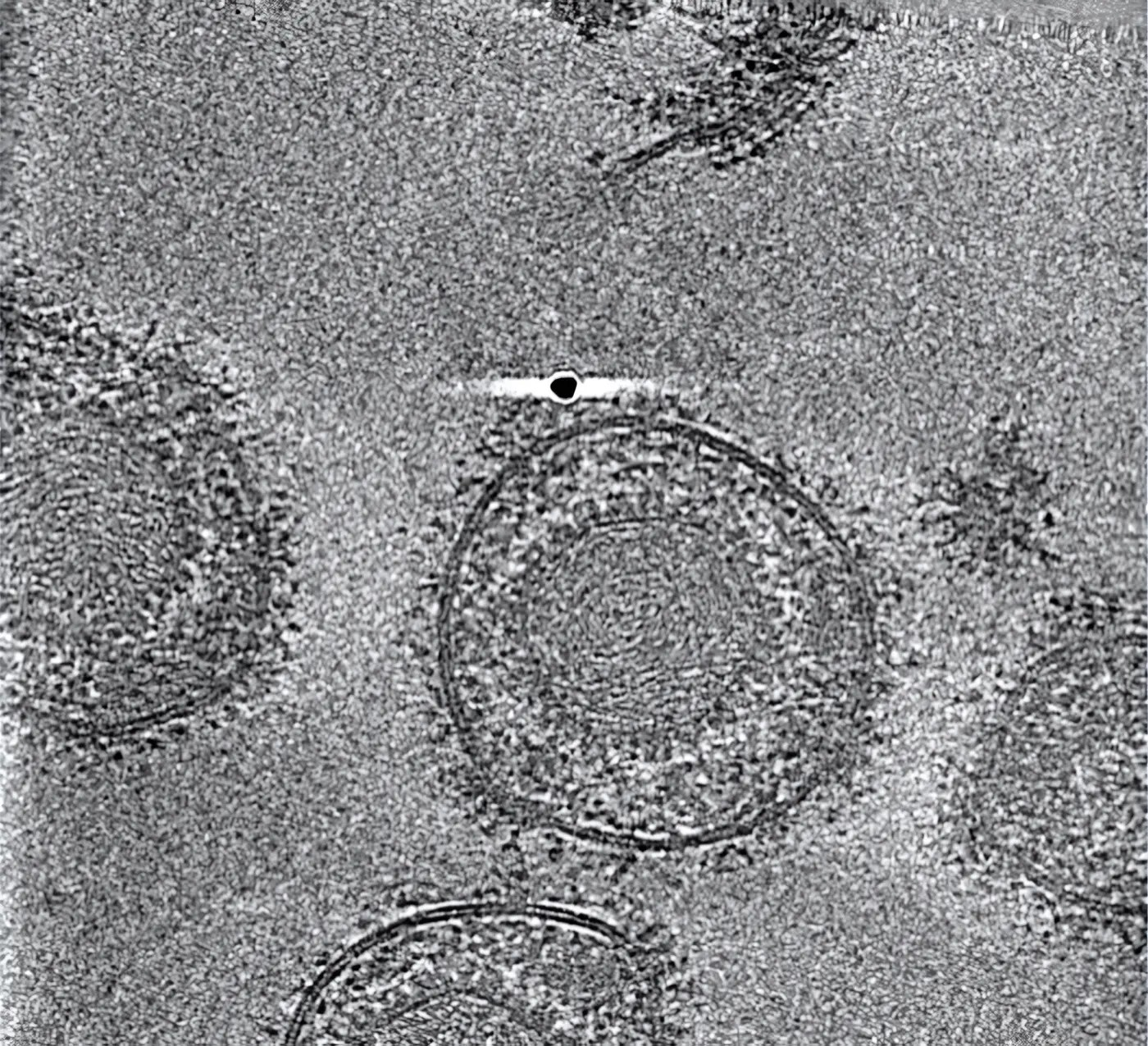 Forschenden haben die HSV-1-Partikel mittels Kryo-Elektronen-Tomografie analysiert.