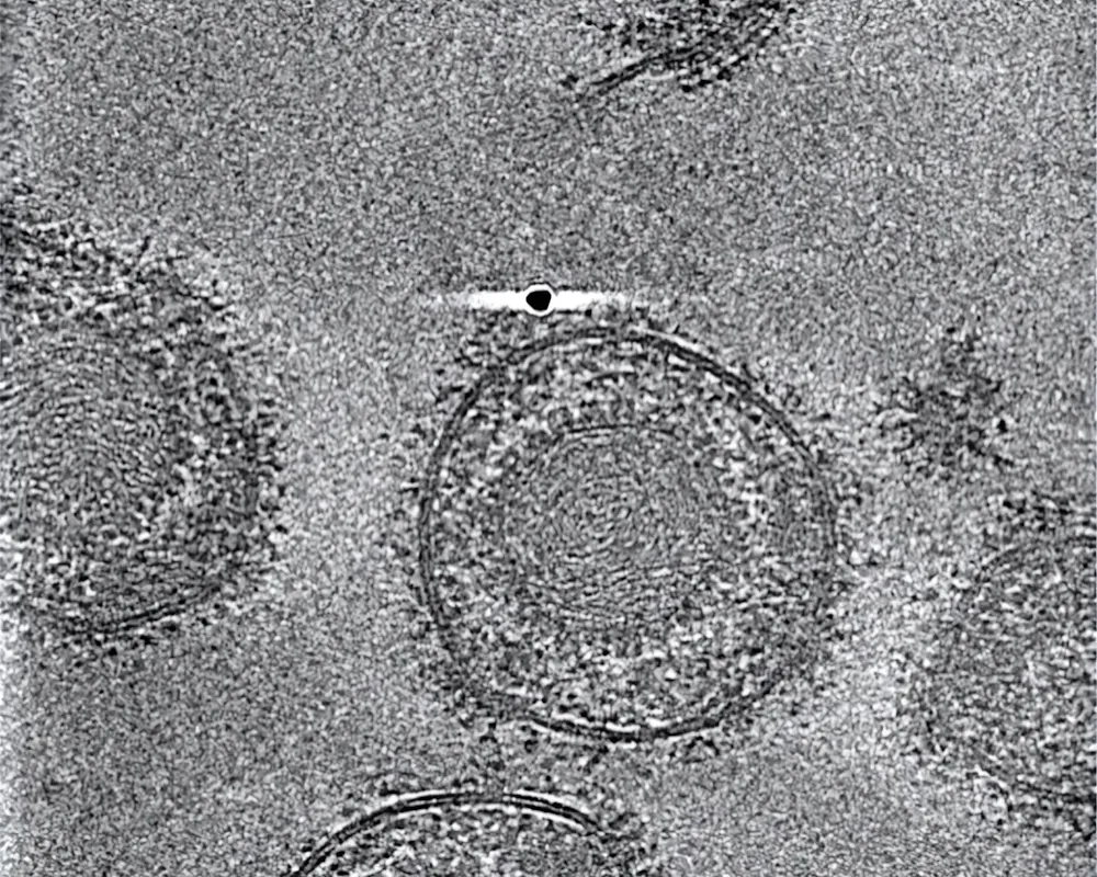 Forschenden haben die HSV-1-Partikel mittels Kryo-Elektronen-Tomografie analysiert. | ©MPG / Benjamin Vollmer / Centre for Structural Systems Biology Forschenden haben die HSV-1-Partikel mittels Kryo-Elektronen-Tomografie analysiert.
