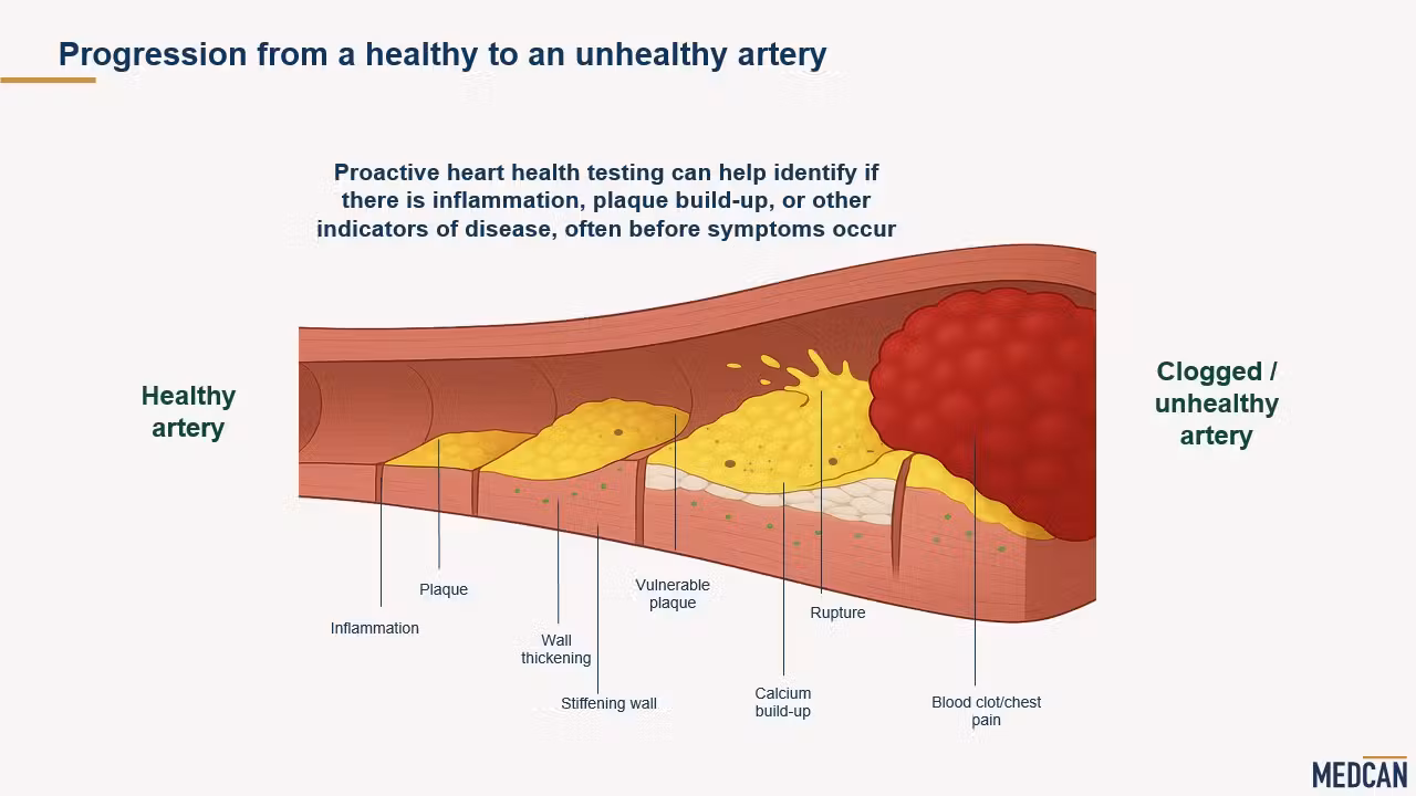 Progression from a healthy to unhealthy artery