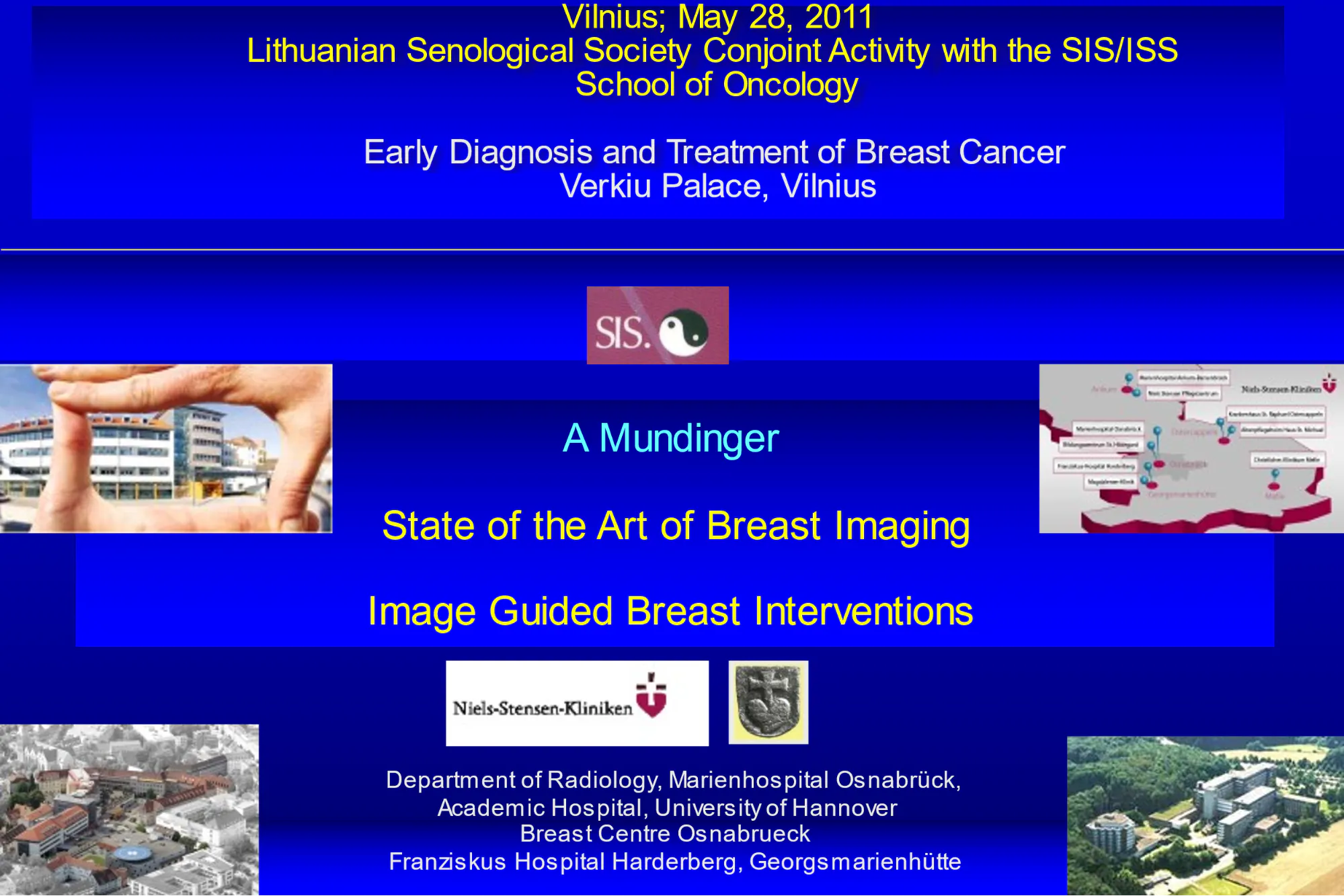 LSDR konferencija 2011-05-27 Skaidrės iš A.Mundinger (Vokietija) pranešimo The new insights in the imagining of DCIS. Update of preoperative Staging of Breast cancer and lymph nodes