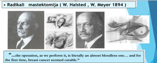 Skaidrė iš V. Ostapeko pranešimo apie krūties vėžio chirurginio gydymo evoliuciją
