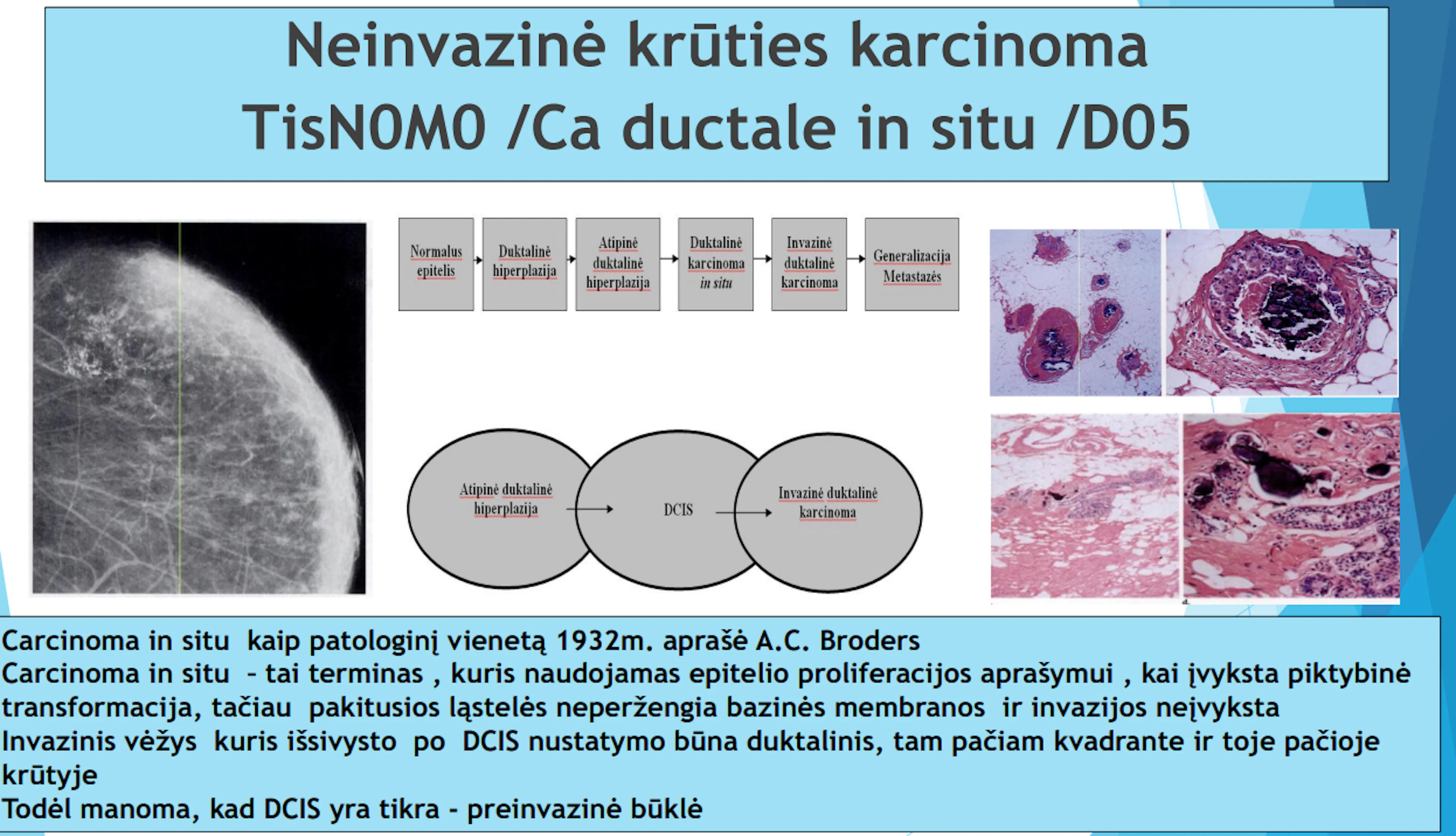 Skaidrė iš V. Ostapenko pranešimo apie neinvazinę krūties O stadijos karcinomą