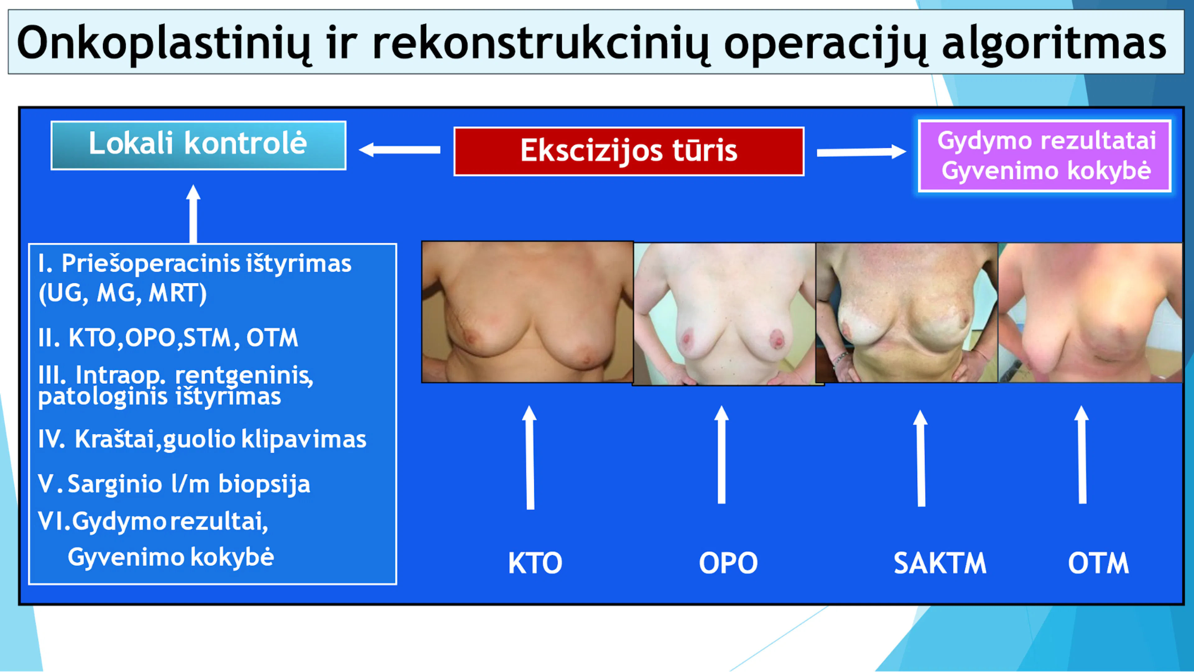 Onkoplastinių ir rekonstukcinių operacijų algoritmas