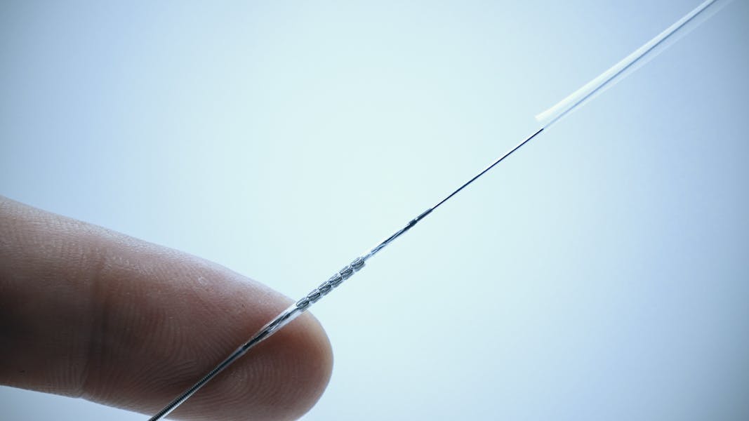 Cum se montează un stent