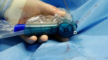 Premieră națională - Sistemul Rotarex pentru trombo-aspirație