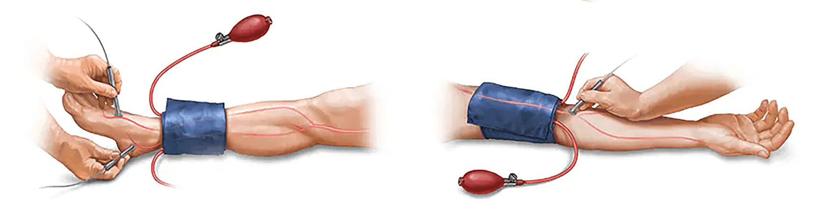 Indice Gleznă/Braț | MONZA ARES