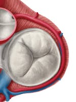 Insuficiența tricuspidiană – cauze, simptome, tratament