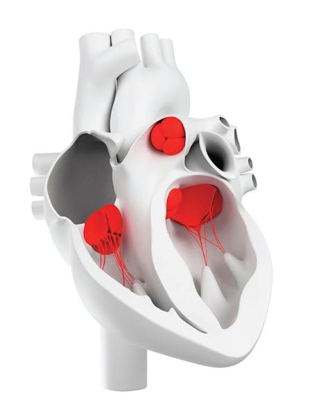 Stenozele valvelor cardiace - cauze, simptome tratament