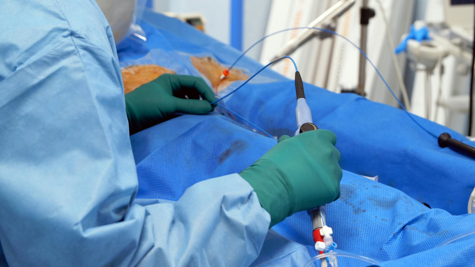 Ablatie de fibrilatie atriala, doctor Dimitrios Lysitsas