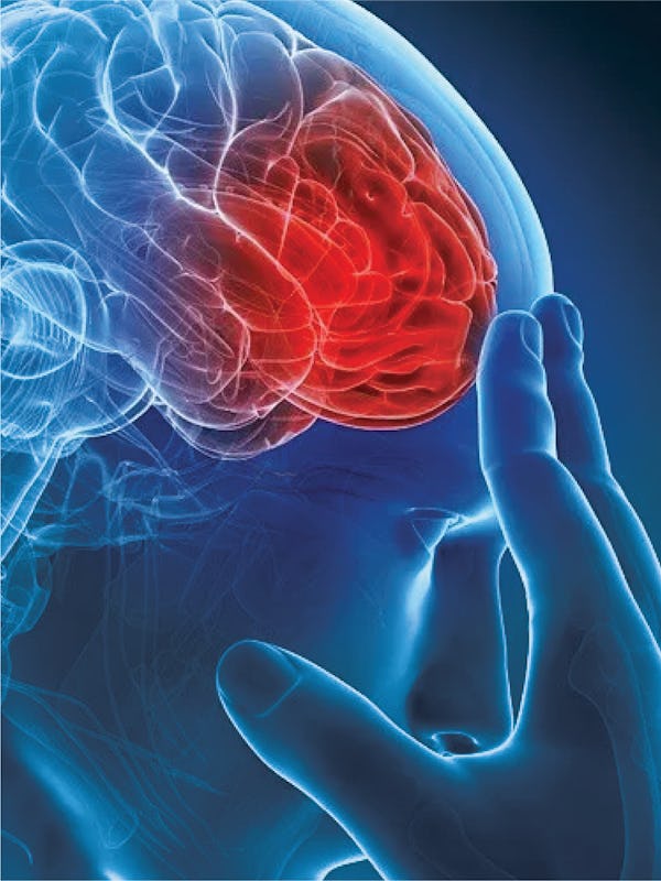 AVC (accidentul vascular cerebral) – tipuri, cauze, simptome, tratament