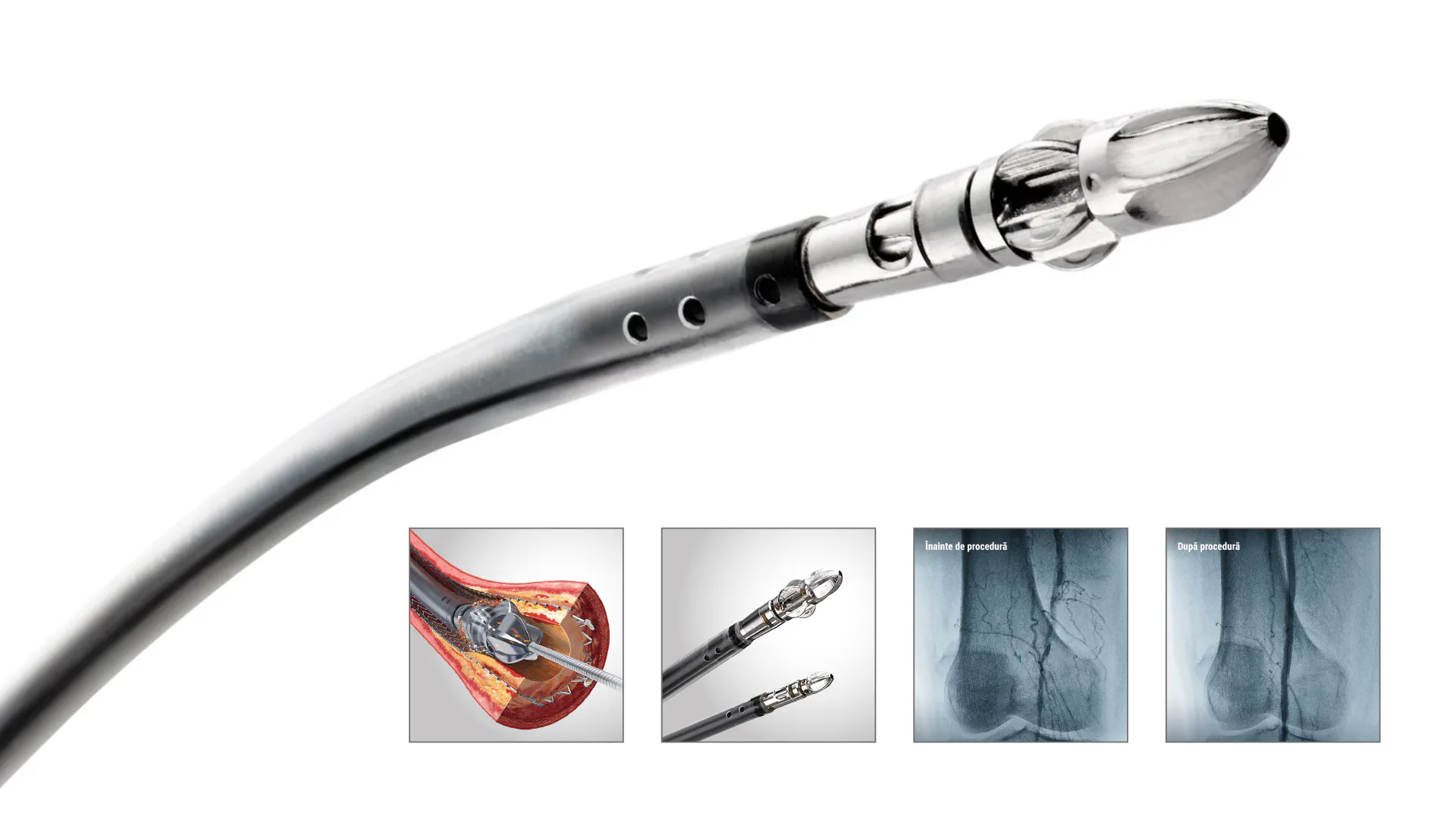 Jetstream vs Shockwave - Tehnologii medicale pentru dezobstrucția ...