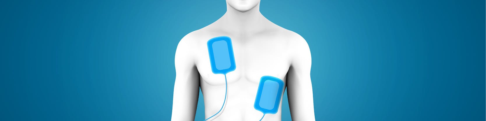 Cum mă pregătesc pentru cardioversia electrică