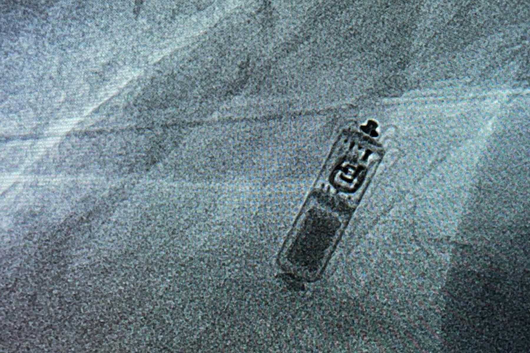 Stimulatorul Micra după implantare