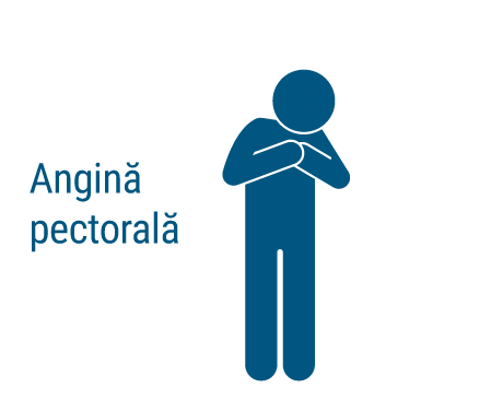 Angina pectorala