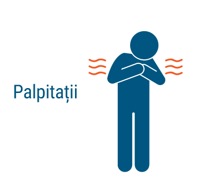 Palpitatii