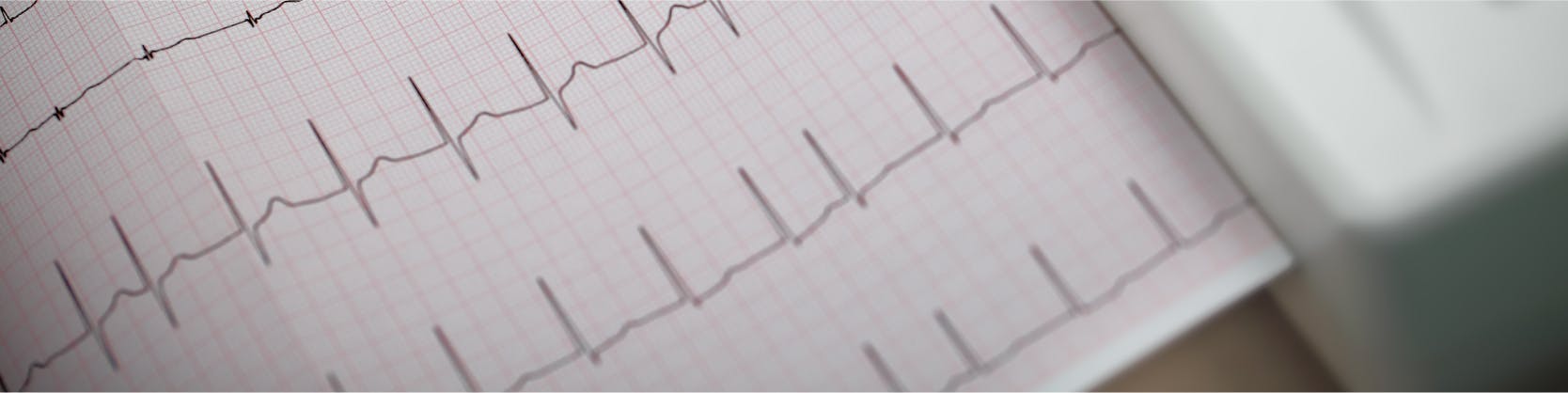 Electrocardiograma - ECG / EKG | MONZA ARES