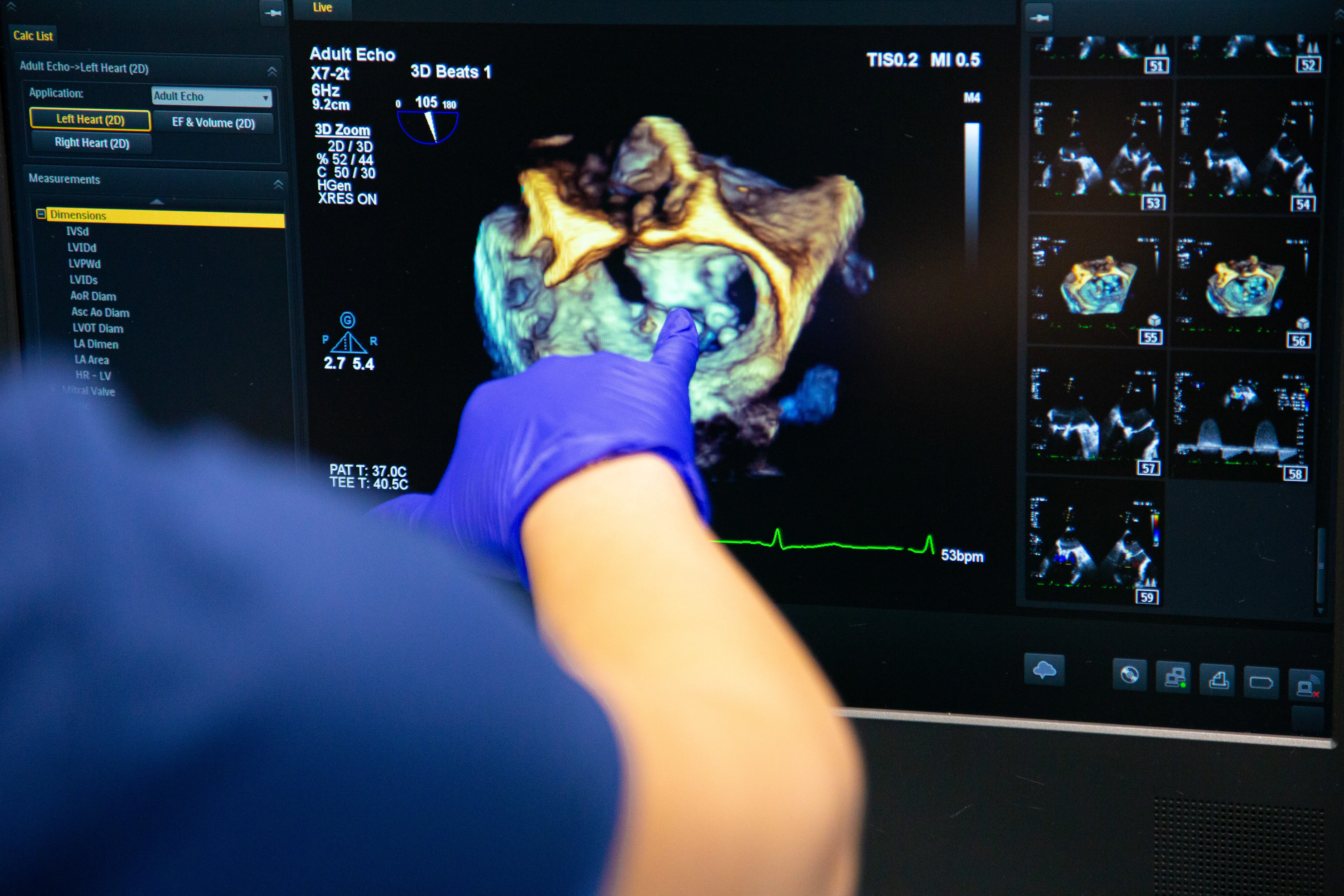 Laboratorul de Ecocardiografie al Spitalului Monza