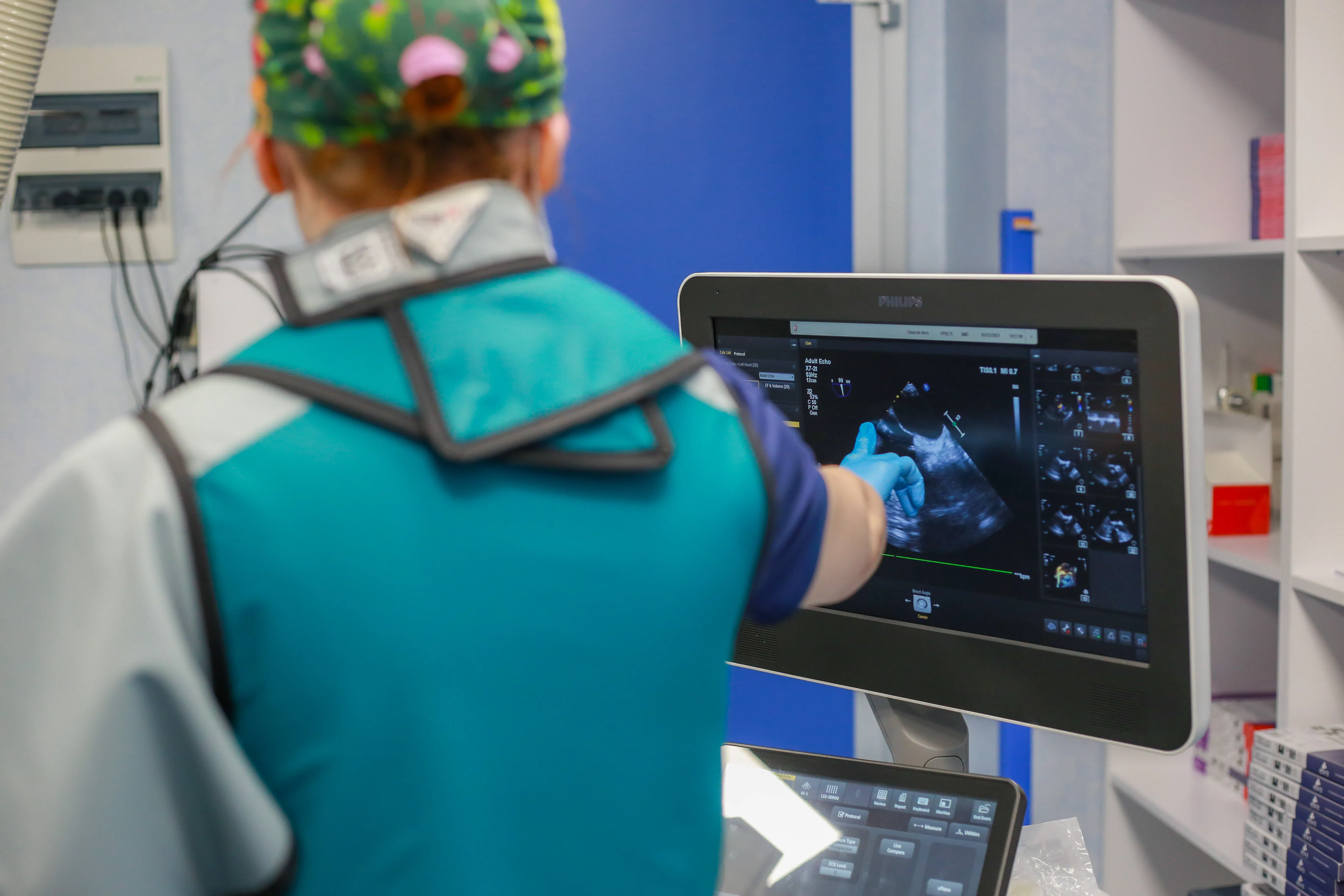 Laborator de Ecocardiografie București | Centru acreditat EACVI | MONZA ARES