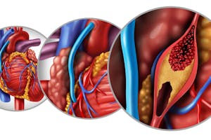 Cum se decide între bypass și angioplastie? Rolul diagnosticului imagistic și al echipei multidisciplinare