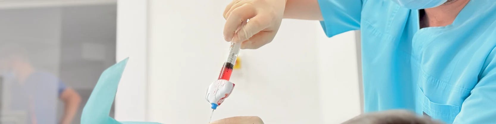Biopsia percutanată ghidată imagistic | MONZA ARES