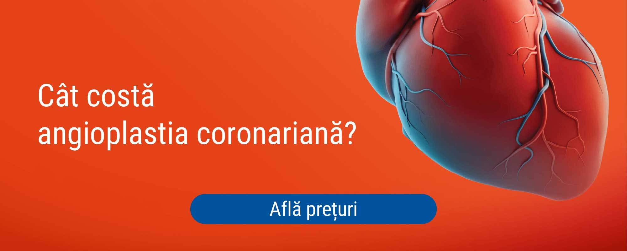 Pret angioplastie cu stent