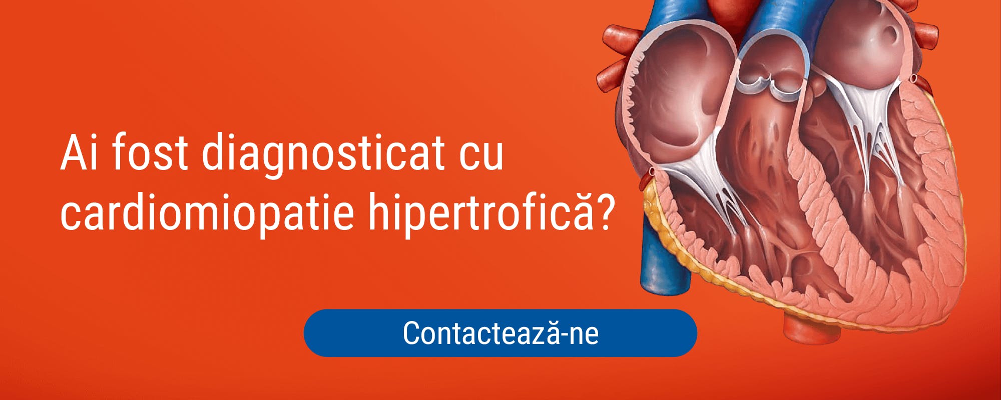Cardiomiopatie hipertrofica