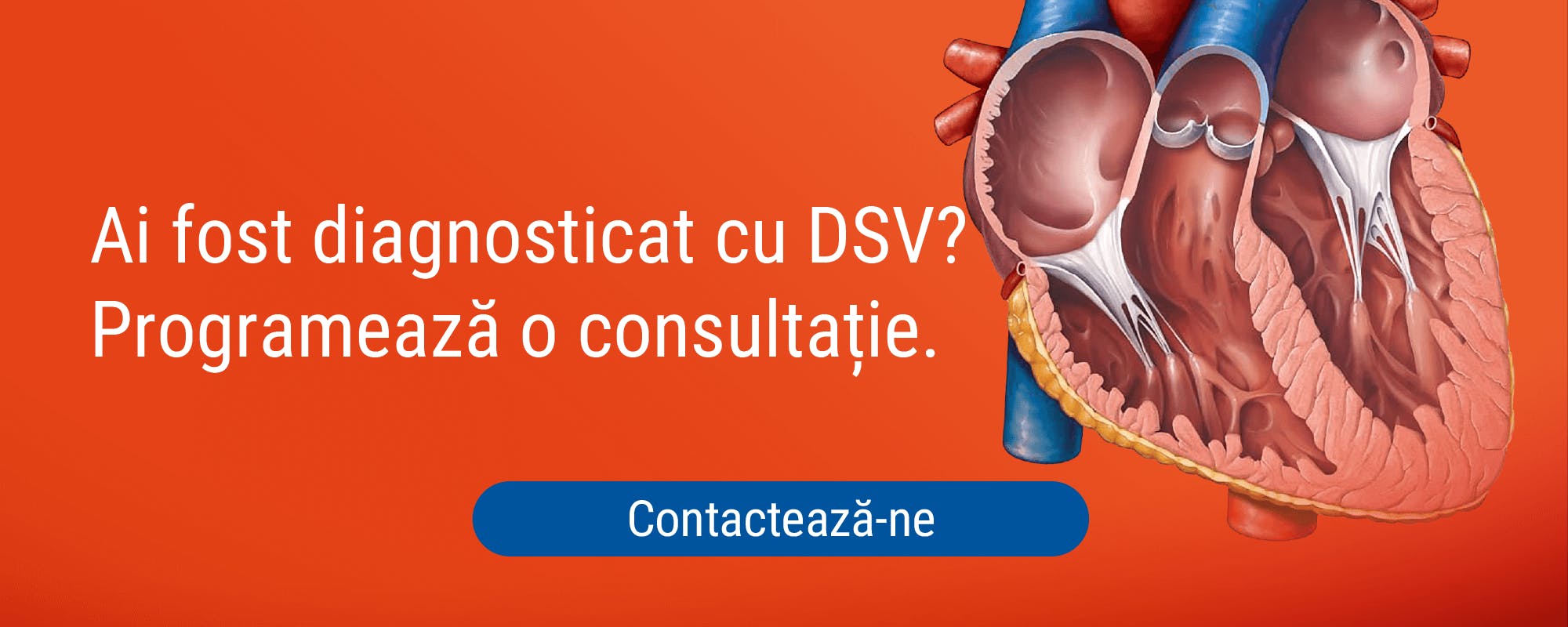 Defect septal ventricular