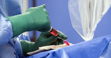 Fibromul Uterin: Histerectomie, miomectomie sau embolizare?