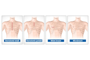 Comparație între intervențiile tradiționale și cele microinvazive: Care sunt beneficiile pentru pacienți?