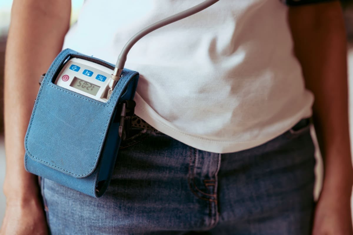 Femeie purtând un Holter TA pentru diagnosticarea și monitorizarea fluctuațiilor tensiunii arteriale.