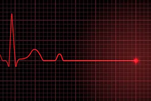 Stopul cardio-respirator: cauze, simptome si opțiuni de tratament