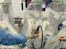 Excizia robotică a unei tumori mediastinale posterioare: chirurgie toracică de mare precizie