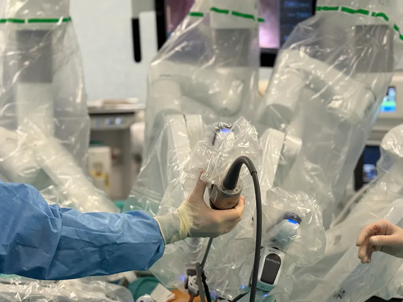 Excizia robotică a unei tumori mediastinale posterioare: chirurgie toracică de mare precizie