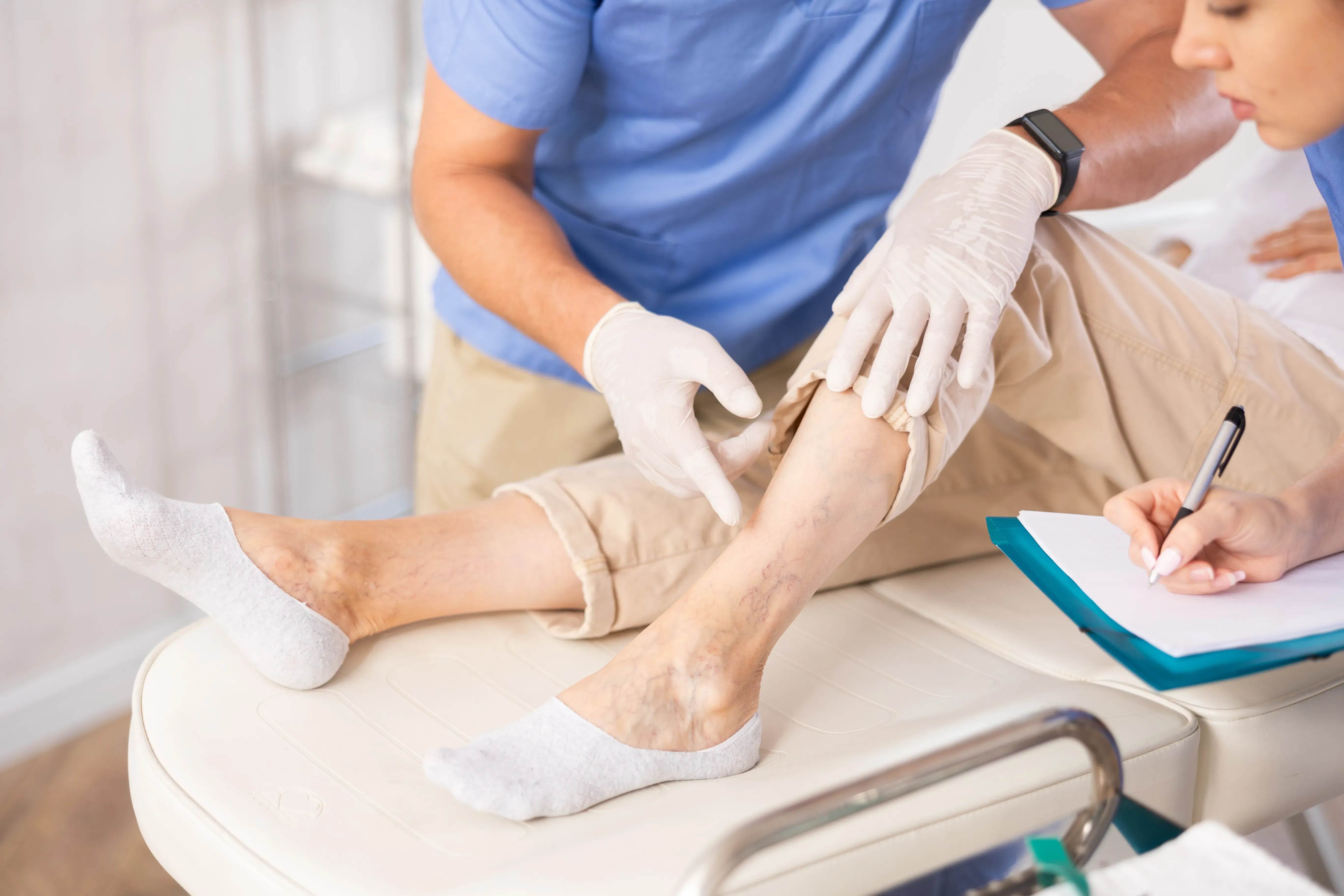 Scleroterapia varicelor: Scapă de venele sparte rapid